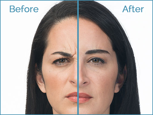 Before and after facial treatment comparison.